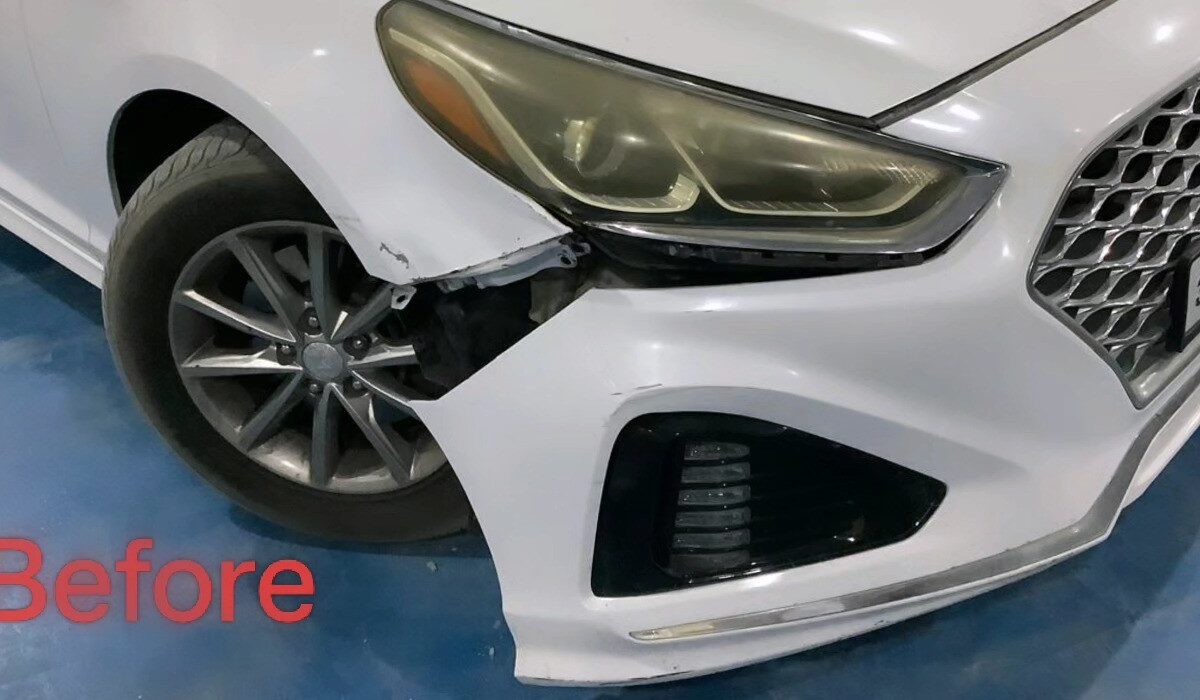Hyundai Sonata before repair